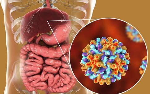 Cách cải thiện sức khỏe của gan
