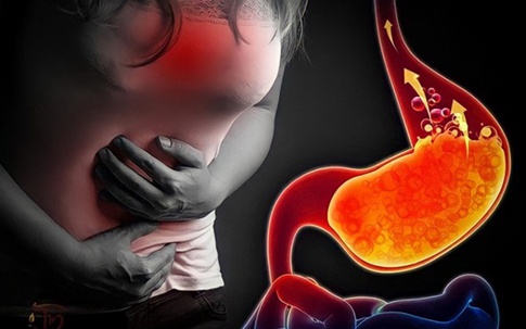 Thực phẩm người bệnh trào ngược dạ dày nên ăn để làm dịu niêm mạc và giảm axit