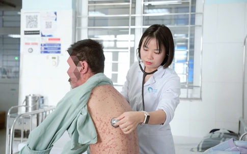 Người đàn ông 43 tuổi bị dị ứng nặng, nhập viện gấp do mắc sai lầm này khi dùng thuốc