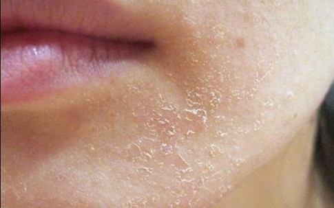 Làn da vào thu: Khi dưỡng ẩm trở thành 'chìa khóa' vàng