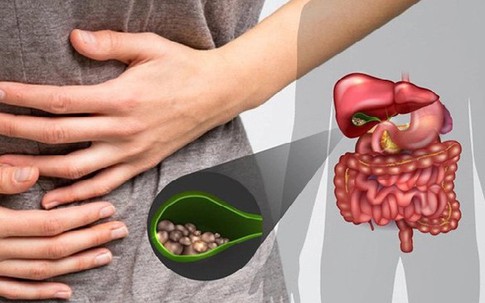 Đau bụng, sụt cân nhanh, người đàn ông phải cắt túi mật thừa nhận 1 sai lầm nhiều người Việt mắc phải