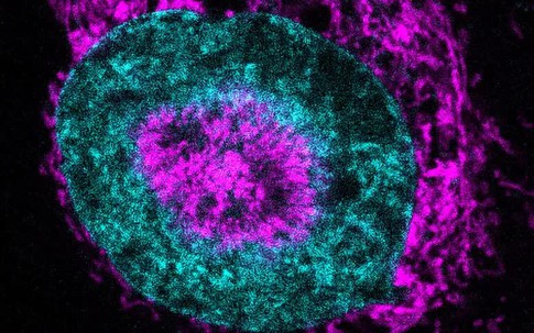 Phát hiện cơ chế “bật năng lượng” khiến tế bào ung thư có thể sống sót