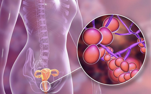 Mang thai bị viêm âm đạo ảnh hưởng thế nào đến thai nhi?