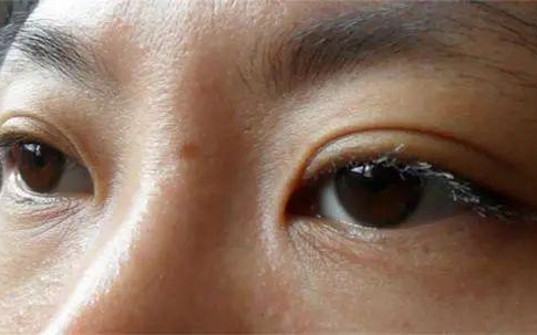 Chỉ cần nhìn vào mặt có thể biết thận của bạn khỏe đến mức nào: Phương pháp cực đơn giản để nuôi dưỡng và tăng cường thận hiệu quả