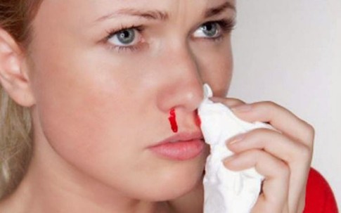 Khô mũi, chảy máu mũi trong ngày hanh khô: Cách chăm sóc và ngăn ngừa hiệu quả