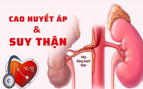 Huyết áp tăng cao, người phụ nữ 39 tuổi đi khám bất ngờ phát hiện nguy cơ mắc bệnh thận mạn