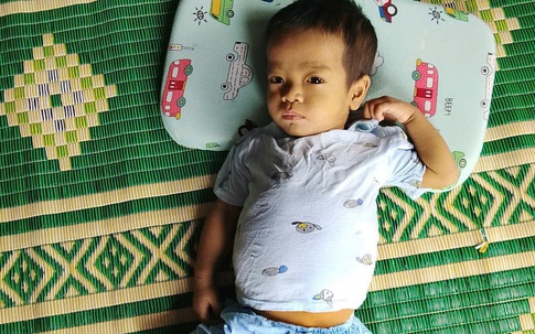 MS 1054: Xót xa hoàn cảnh bé trai bị teo mật bẩm sinh, mẹ sẵn sàng hiến gan cứu con nhưng không đủ kinh phí điều trị