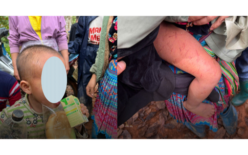 Sau một đêm mưa rét, bé trai 4 tuổi ở Lai Châu được tìm thấy ở nơi không ai ngờ tới