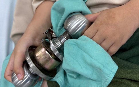 Nghịch dại, bé 5 tuổi ‘ôm’ ổ khóa nhập viện cấp cứu