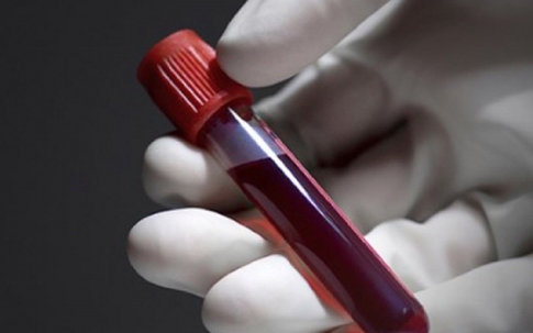 Con gái ngày càng giống người yêu cũ của vợ, tôi muốn xét nghiệm ADN