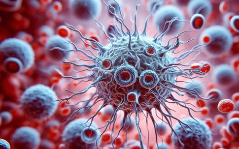 Thói quen ăn uống tạo tiền đề cho tế bào ung thư: Nhiều người Việt đang lặp lại mỗi ngày