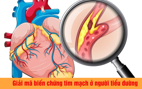 Giải mã biến chứng tim mạch ở người tiểu đường