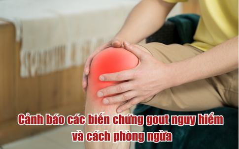 Cảnh báo các biến chứng gout và cách phòng ngừa