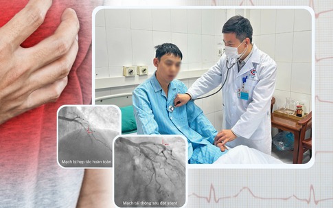 Người đàn ông 46 tuổi người nước ngoài bị nhồi máu cơ tim cấp thoát chết trong gang tấc