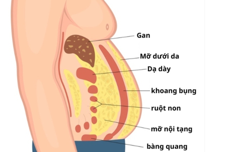 4 dấu hiệu cho thấy bạn có mỡ nội tạng và 4 thực phẩm là khắc tinh của mỡ