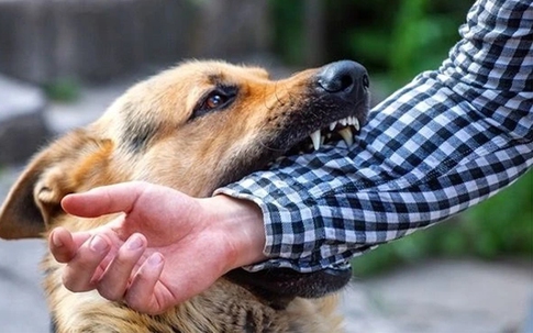 Bé trai 13 tuổi nguy kịch sau 2 tháng bị chó cắn vì việc làm này của người thân