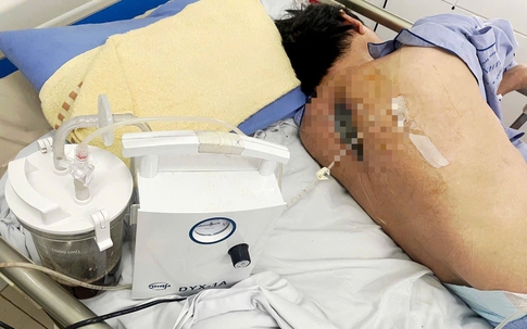 Người đàn ông 57 tuổi ở Hưng Yên sốt kéo dài, liệt hai chân từ nguyên nhân không ngờ