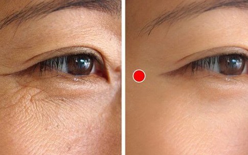 5 động tác đơn giản hằng ngày xóa mờ nếp nhăn đuôi mắt