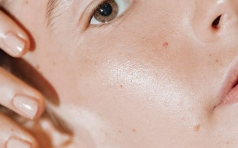 Làm thế nào để có làn da khỏe đẹp?