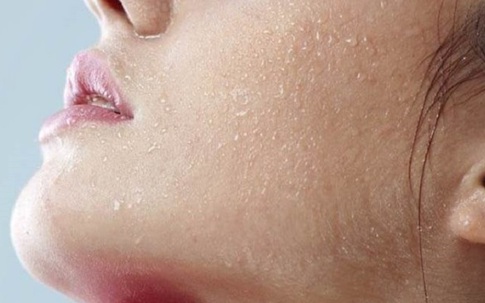Nếu da khô, bong tróc, cẩn thận dấu hiệu của suy giáp và 5 dấu hiệu bất thường trên da cảnh báo sức khỏe