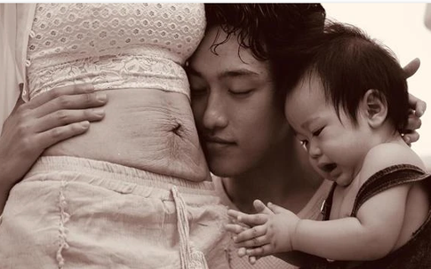 'Hôn lên vết sẹo' – Khi sự tổn thương cũng xứng đáng được yêu