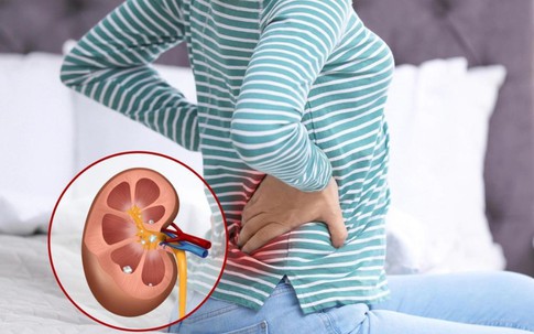 Dấu hiệu cảnh báo suy thận người Việt không nên bỏ qua
