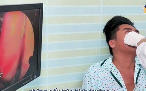 Người đàn ông 40 tuổi hứng chịu đau đầu âm ỉ suốt thời gian dài vì một sai lầm nhiều người Việt mắc phải