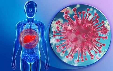 Người đàn ông 34 tuổi ở Hà Nội bị xơ gan thừa nhận 1 sai lầm khi điều trị viêm gan B nhiều người Việt mắc phải