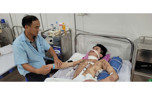MS 1016: Mong một phép màu cho nam sinh bị bỏng điện cao thế 55% cơ thể