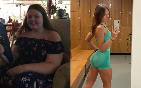 Bị gọi là 'cá voi', cô gái Anh 105 kg lột xác nhờ giảm 52 kg