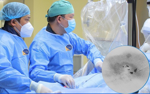Người đàn ông 64 tuổi đang khỏe mạnh, bất ngờ đột quỵ từ dấu hiệu nhiều người Việt bỏ qua
