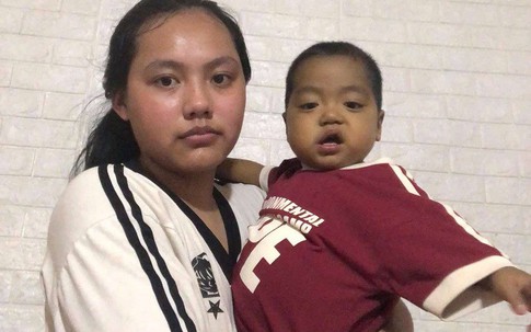 MS 1018: Sự sống mong manh của bé trai 21 tháng tuổi bị teo mật bẩm sinh, xơ gan