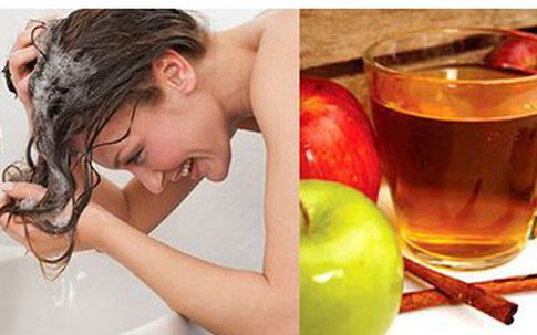 Tại sao nên dưỡng tóc với giấm?