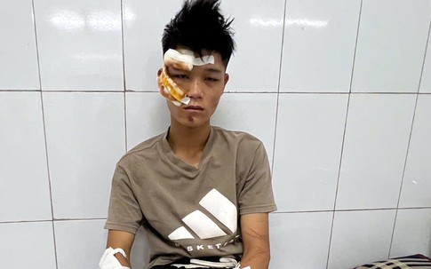 Chi tiết lời khai của đối tượng lái xe 'thông chốt', tông Đại úy Lê Đình Công