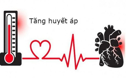 Đừng coi thường: 5 dấu hiệu tăng huyết áp ở người trẻ có thể dẫn tới đột quỵ sớm