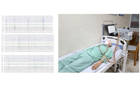 Người đàn ông 31 tuổi ở Phú Thọ đau bụng, mất ngủ liên tiếp, đi khám bất ngờ phát hiện bệnh nguy hiểm