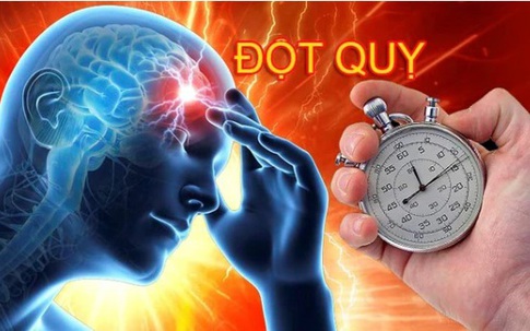 Tin vui cho người bệnh đột quỵ: Thêm cơ hội hồi phục cho người bị đột quỵ 'quá giai đoạn vàng'