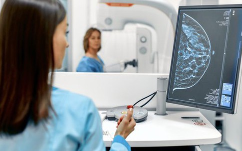 Trí tuệ nhân tạo (AI) giúp phát hiện chính xác ung thư vú