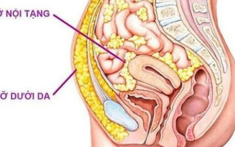 6 điều bạn nên làm để giảm mỡ nội tạng hiệu quả, bền vững