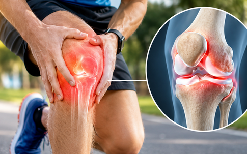 Càng đi bộ càng đau khớp gối: Sai lầm tập luyện người sau tuổi 50 không nên mắc