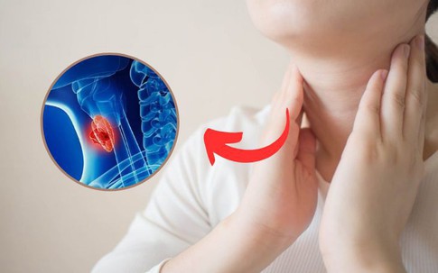Hai chị em lần lượt phát hiện ung thư tuyến giáp từ việc làm nhiều người Việt bỏ qua