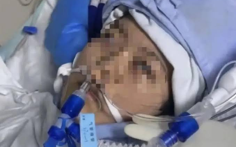 Cô gái 24 tuổi đột ngột ngừng tim sau buổi phỏng vấn xin việc: 5 dấu hiệu cảnh báo không nên bỏ qua