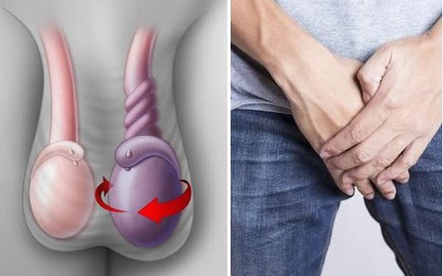 Bé trai 14 tuổi bị cắt bỏ tinh hoàn vì một sai lầm nhiều cha mẹ Việt mắc phải