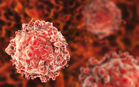 Người đàn ông 65 tuổi phát hiện ung thư dương vật từ dấu hiệu nhiều nam giới Việt bỏ qua