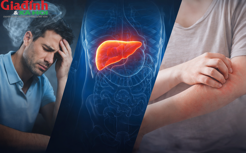 3 dấu hiệu cảnh báo cơ thể đang quá tải, sắp 'vượt ngưỡng': Đừng bỏ qua nếu xuất hiện thường xuyên