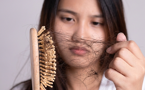 Sự thật về rụng tóc khi dùng biện pháp tránh thai nội tiết tố