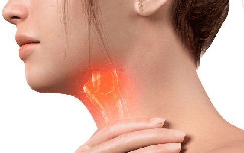 Tại sao viêm thanh quản thường gặp ở người 'nói nhiều' và cách hỗ trợ cải thiện hiệu quả