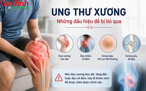 Đau xương kéo dài, đau nhiều về đêm: Bác sĩ cảnh báo dấu hiệu ung thư xương dễ bị bỏ qua