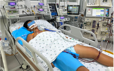 Nắng nóng, thiếu niên 15 tuổi sốc nhiệt nguy kịch, tổn thương gan, thận khi chơi thể thao