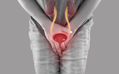 Ung thư bàng quang tái phát lần 3: Dấu hiệu cảnh báo bệnh rất dễ bị bỏ qua